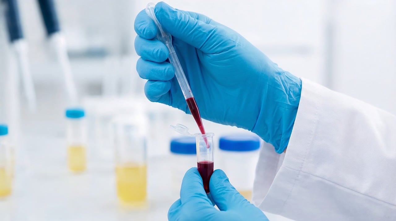 laboratory science research blood sample pipette glove medical analysis clinical test healthcare biotech experiment technician sterile chemistry vial fluid diagnostic ai generated