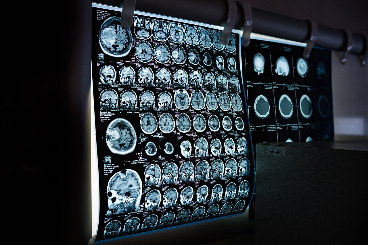 x-ray mri ct scan